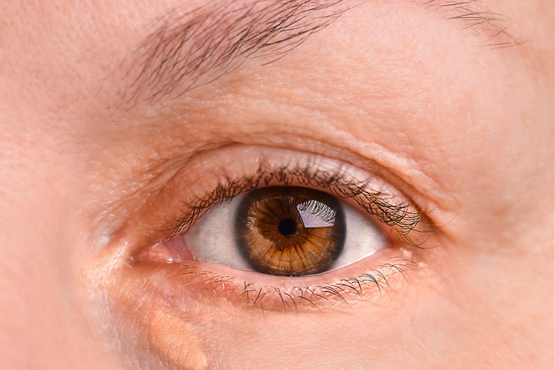 Ezzel az elváltozással jelzi a szeme, ha magas a koleszterinszintje