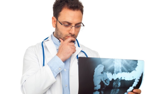 A vastag-, és végbélrák kialakulása nagyon szoros összefüggést mutat az életmóddal