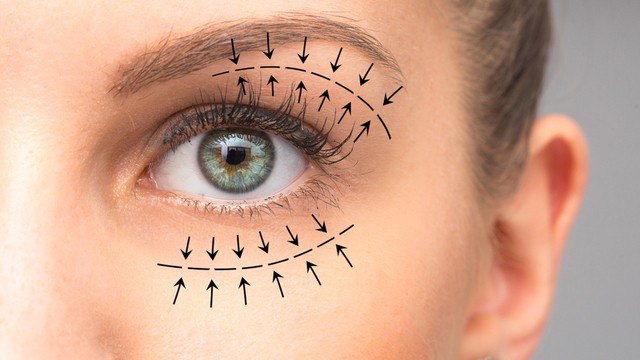 Szemhéjplasztika: hogyan végzik, mire számíthatunk?