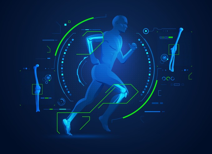 Mozgásanalízis: terhelés közben mutatja meg az ízületi elváltozást című cikk nyitóképe