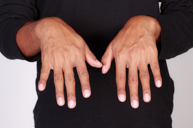 Fehéres, opálos körmök: ilyen jelekből sejthető, ha bajban van a máj