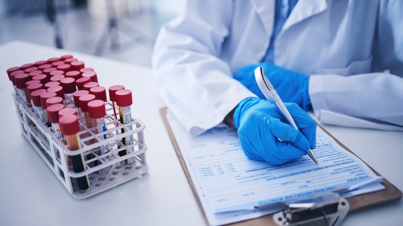 tumor rák daganat kimutatása vizsgálat labor érték