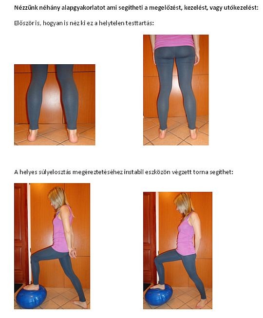 Sarkantyú kezelése gyógytornával