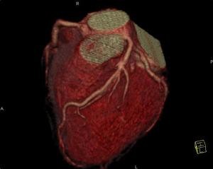 A Cardio-CT lényege