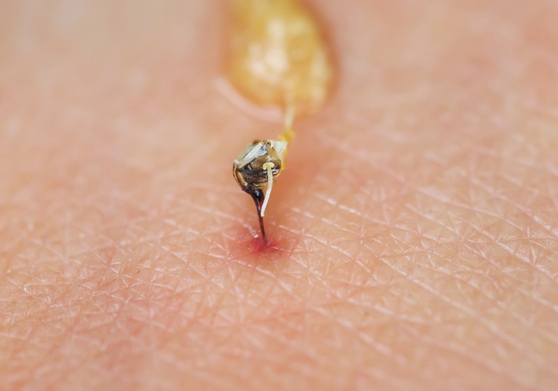 Méhcsípés és dióallergia: létezik olyan teszt, ami kimutatja? Az orvos válaszol