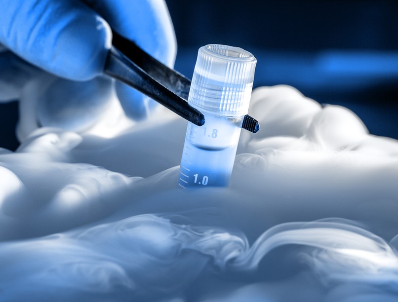 meddőség gyermekáldás, pszichológus, lombik