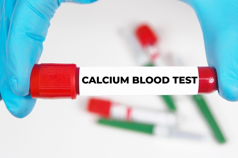 Mit jelent a kalcium érték a laborleleten?