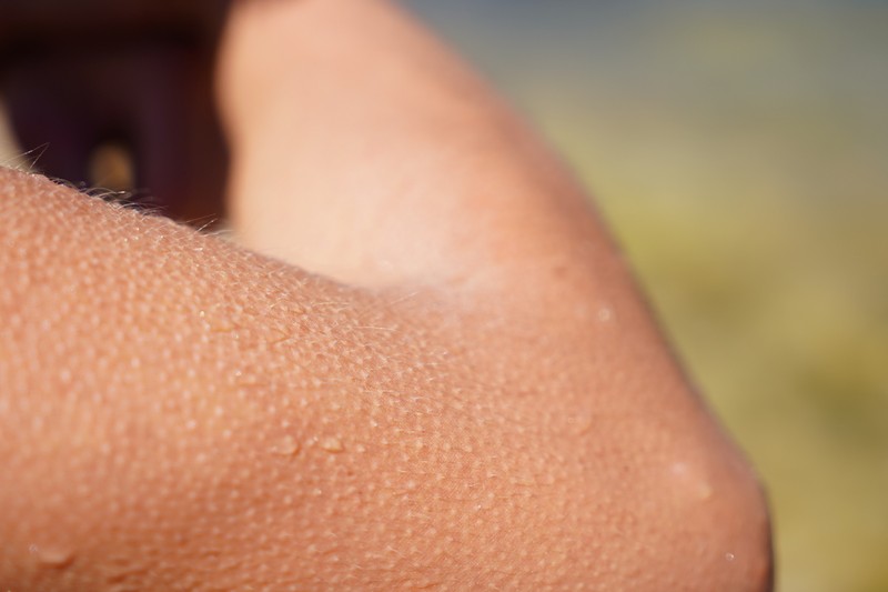 Miért leszünk libabőrösek egy megható pillanattól? Ez történik a testünkben