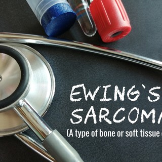 Ewing-szarkóma című cikk nyitóképe