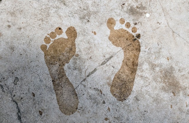 Ezekre az állapotokra derülhet fény, ha jól megnézi a lábnyomát