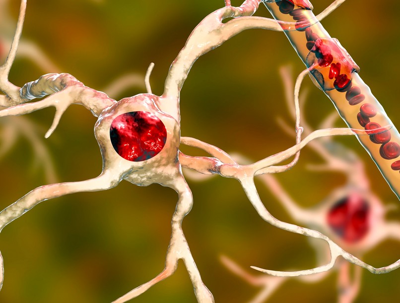 koleszterin-megvonás daganat kiéheztetése