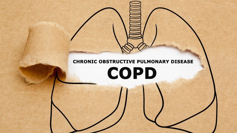 copd, diéta, tüdőbetegség