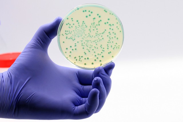 Sokkal nagyobb pusztítást végzett a szuperbaktérium a spanyoloknál, mint eddig hitték