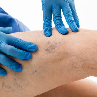 Mi a pókhálóvéna, seprűvéna? című cikk nyitóképe