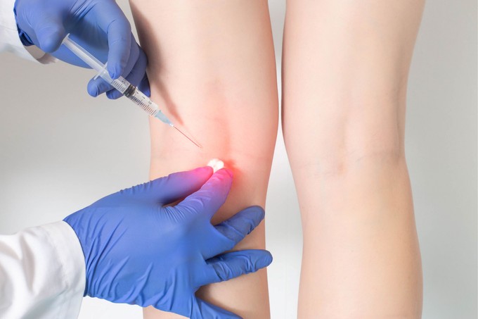 Így szabaduljon meg gyorsan a fájdalomtól nyaralás előtt - ez a fájdalomspecialista tanácsa című cikk nyitóképe