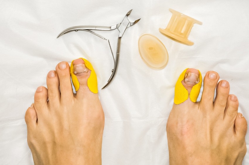 Ha egy laikus ránéz a körmünkre, legfeljebb annyit állapít meg, hogy le kéne vágni vagy meg kellene tisztítani. De egy szakorvos azonnal sok mindent kiolvas belőle a rossz táplálkozástól a stresszen át a veseproblémákig.