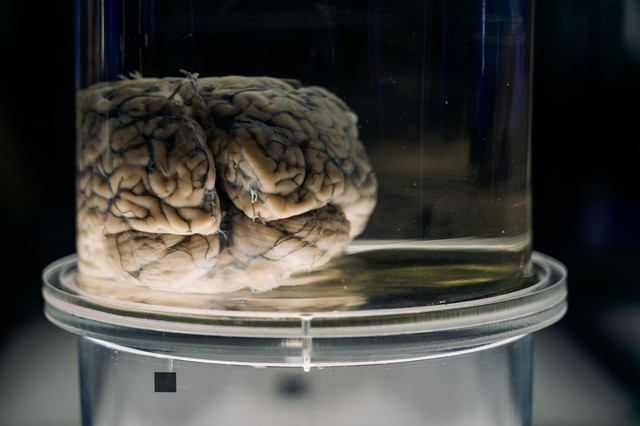 Hetven éve darabokra vágták – most kínai tudósok vizsgálnák Einstein feldarabolt agyát