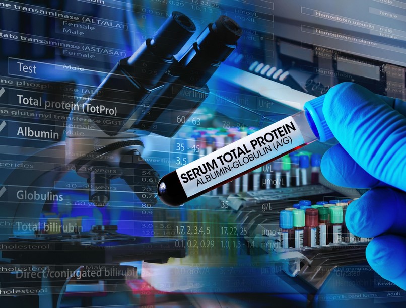 lisztérzékeny, ok, vizsgálat, kimutat, cöliákia