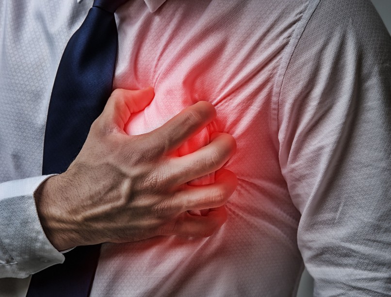 szívinfarktus, trombózis, vérrögösödés, érelzáródás, szívroham