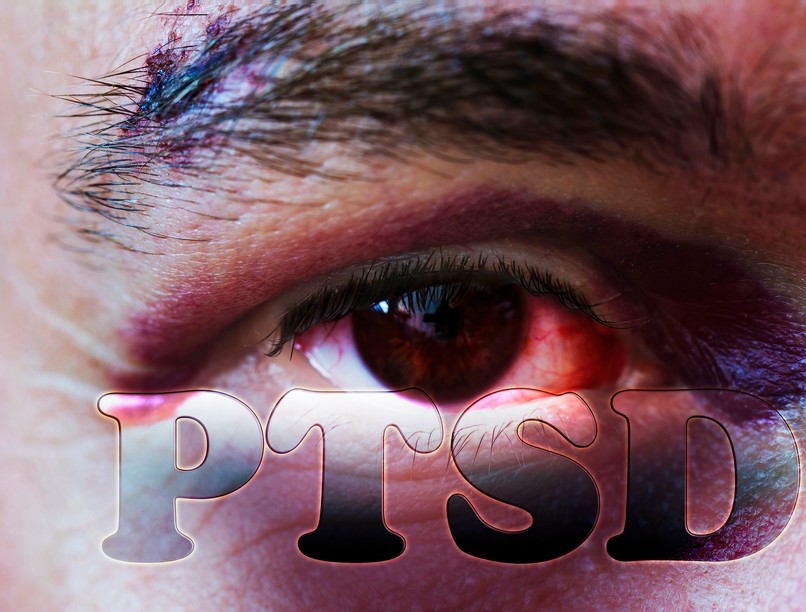 Poszttraumás stressz zavar (PTSD) tünetei, vizsgálata és kezelése