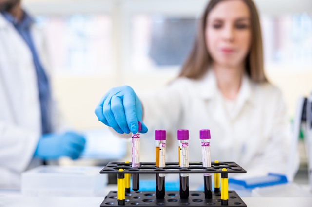 Vastagbélrák - már egy vérvizsgálat is jelezheti a betegséget és az azt megelőző elváltozásokat