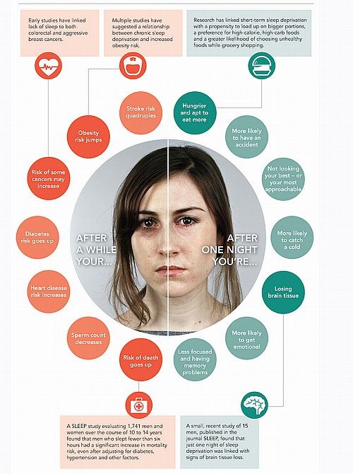 A kialvatlanság, alvászavar egészségkárosító hatásai