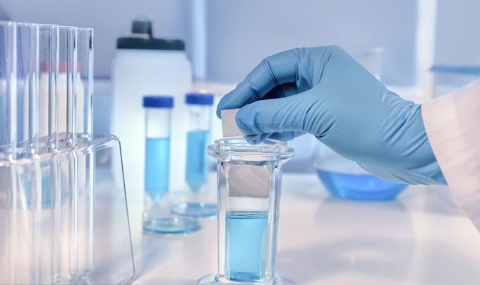 Melyik érték jelez tumort a leleten a gyakorlatban? Az onkológus elmondja című cikk nyitóképe