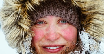 Miért pirosodik ki az arcunk, amikor melegünk van vagy fázunk?