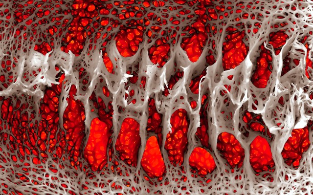 Ételekkel kipucolhatók az erek?  Ilyen vitaminok használnak, ha már rozsdásodnak az erei