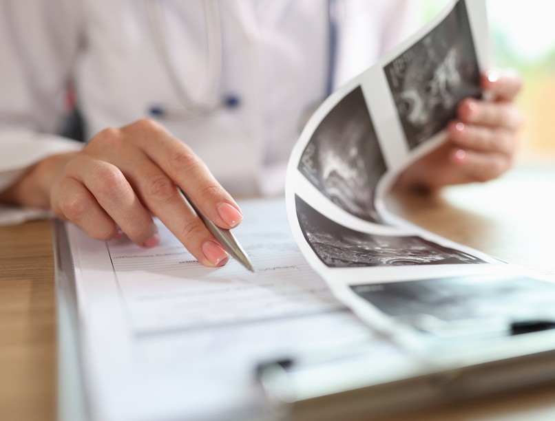 méhpolip tünet sejtburjánzás rák jele