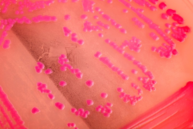 Mi a mikrobiológiai tenyésztés és mit mutat ki?