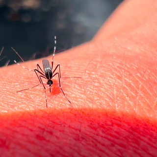 Sárgaláz: tünetei, vizsgálata és kezelési lehetőségei című cikk nyitóképe