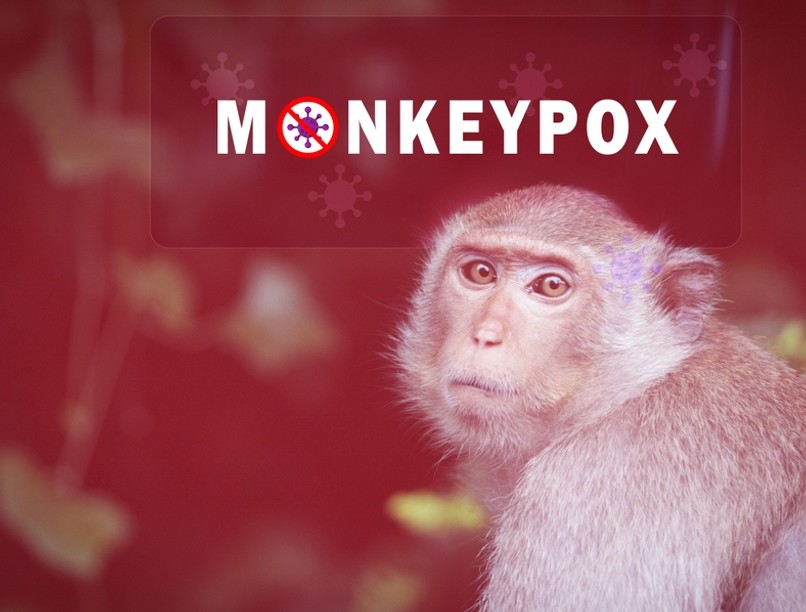 majomhimlő, majomhimlő tünetei, majomhimlő terjedése 