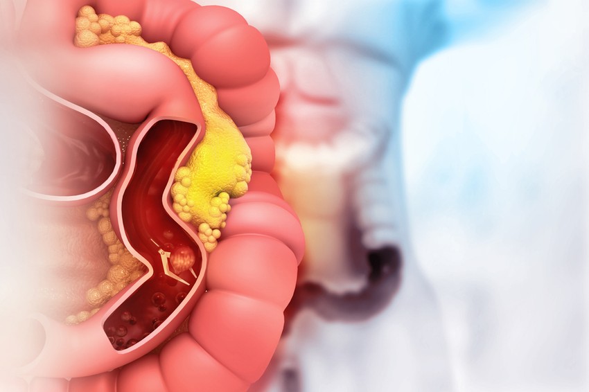 Napjainkban több mint 6000 ritka betegség létezik, amelyek 80%-a genetikai okokra vezethető vissza.