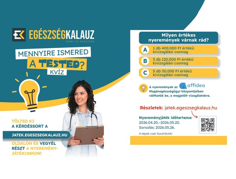 Mennyire ismered a tested nyeremény játék kvíz