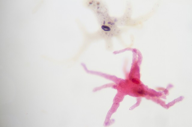 Veszélyes agyevő amőba ellen találtak megoldást a kutatók