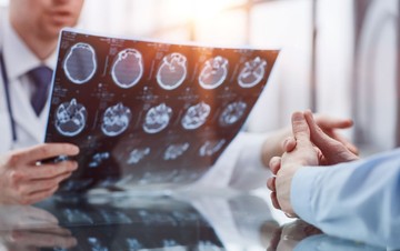 Nem csak fejfájás: 12 meglepő tünet, ami agydaganat jele is lehet