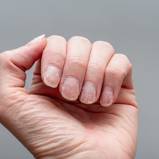 Mit árulnak el a körmeink az egészségünkről? 7 aggasztó jel, amire jobb felfigyelni című cikk nyitóképe