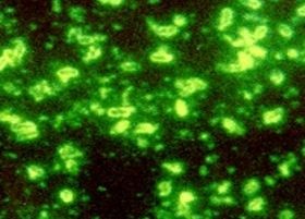 A legpusztítóbb járványokat okozó betegségekről, a pestisről, koleráról, himlőről, lepráról mindenki hallott, ha másutt nem, a történelemórákon.