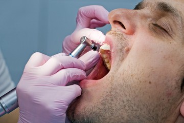 Ne lepődjön meg, ha ezt tapasztalja foghúzás után