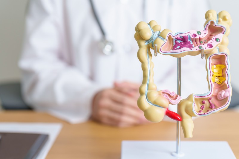 Migrén: a bélrendszerünkben lehet az ellenszere?