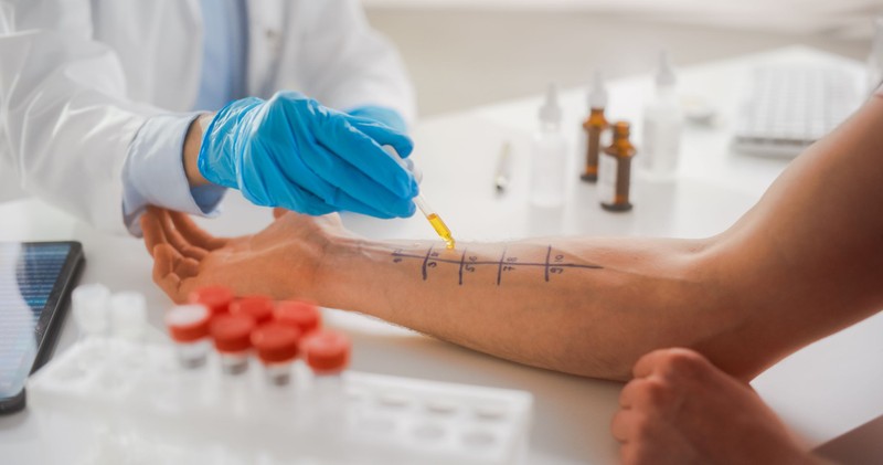 Nem minden allergiavizsgálatnál végezhető bőrpróba! A szakorvos elmondja az okokat