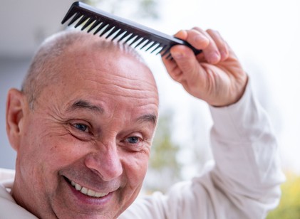 Komoly áttörést ígér a kopaszodás elleni küzdelemben egy új szer című cikk nyitóképe