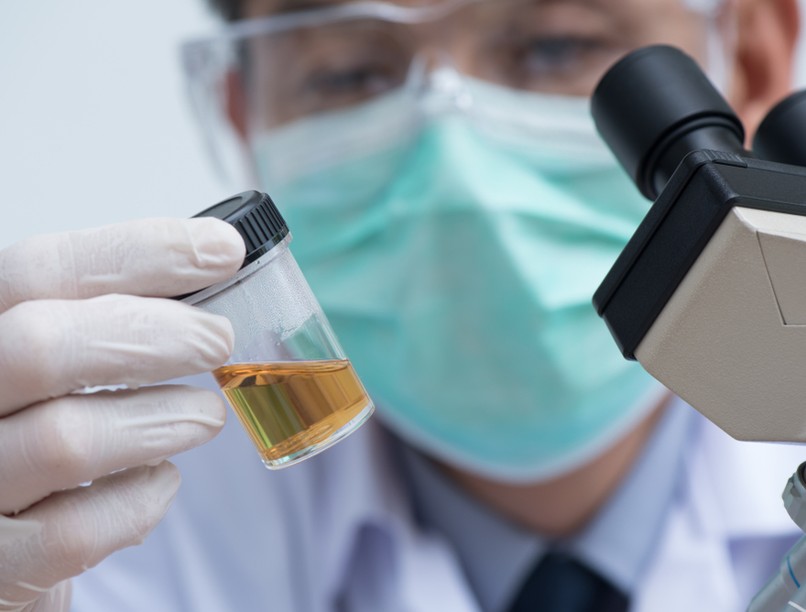 vizeletvizsgálat, HPV, méhnyakrák