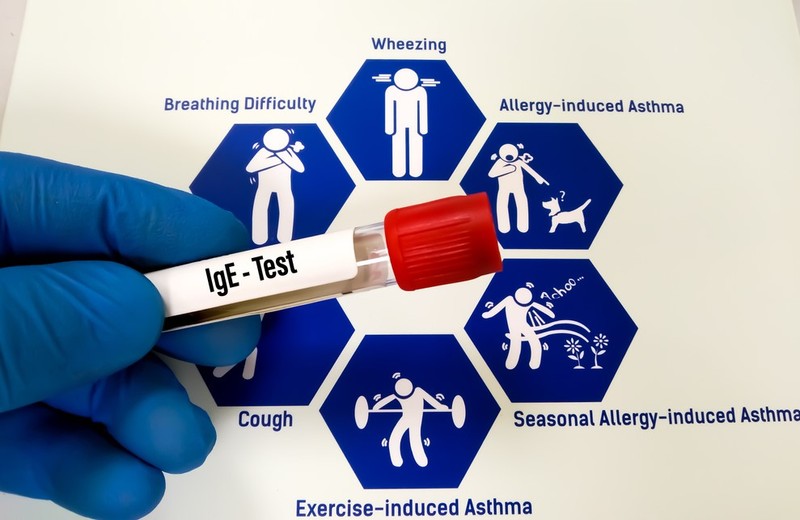 Egyetlen teszttel több allergiás tünetet is kivizsgáltathat - tanácsolja az allergológus
