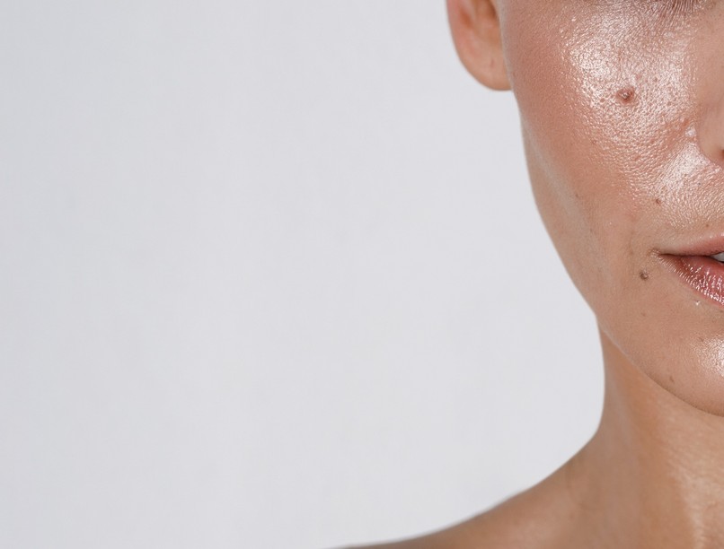 Mi a fokozott bőrzsírosodás faggyútermelés