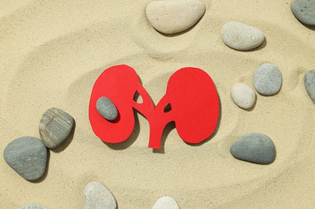 Szúró, csípő érzés a vizelés legvégén? Ez a vesehomok egyik legjellegzetesebb tünete