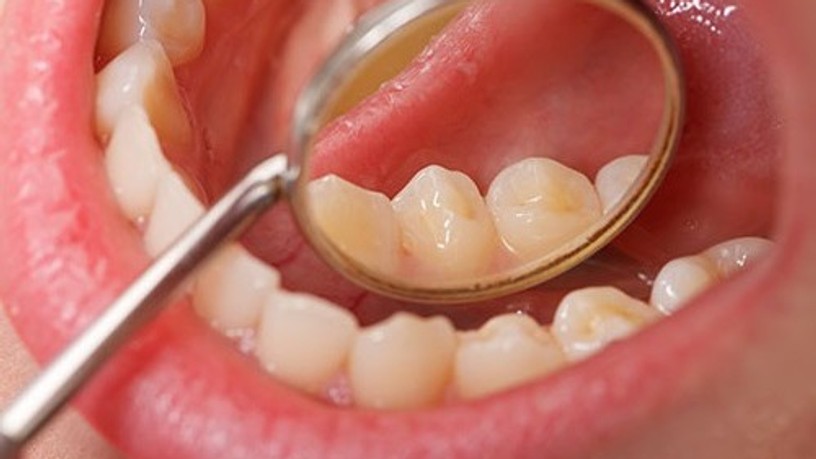 oral-cancer-screening_3