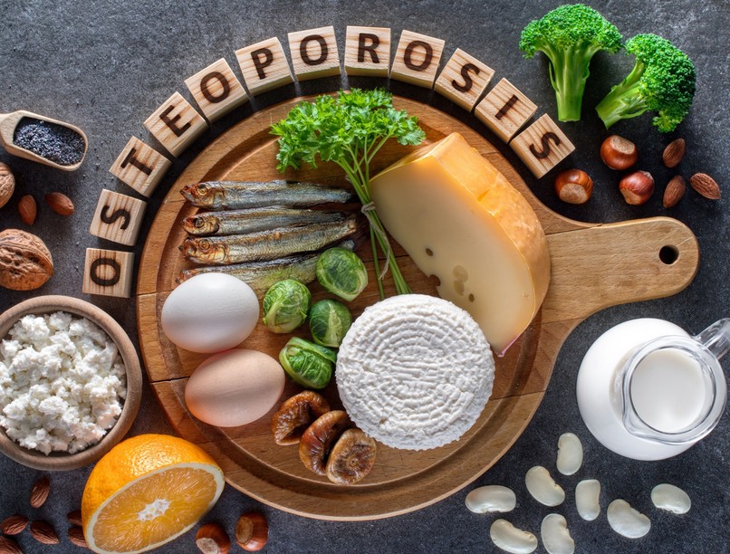 mi jó csontritkulás ellen étel táplálkozás MDOSZ