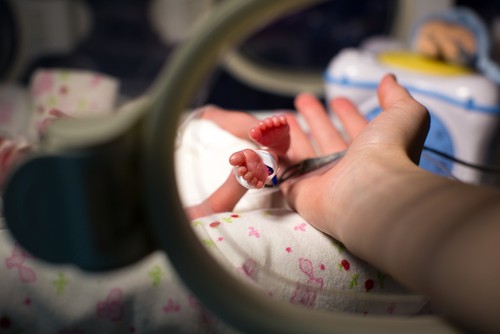 A koraszülött gyermekeknek meg tudják teremteni a megfelelő körülményeket a kórházban.